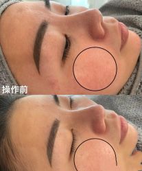 -SKIN79皮肤管理中心