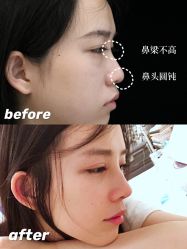 -Yestar宁波艺星整形医院
