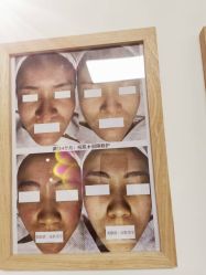 -美肤盾祛痘·问题肌头疗管理中心