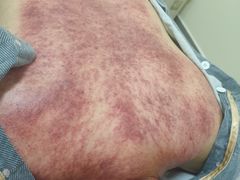 -张钰强中医正骨推拿连锁(唐家人才公寓店)
