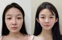 -Yestar重庆艺星医疗美容医院