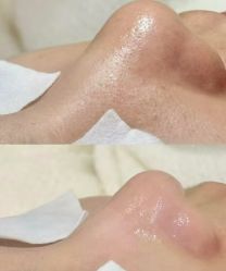 -美愈美肤MEIYU SKIN