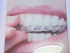 -上海仁爱医院口腔科 · 种植