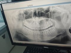 -微笑牙科口腔(三亚迎宾院区)