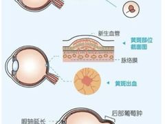 -天津大学爱尔眼科医院(天津院区)