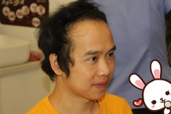 -大麦微针植发丨全国连锁