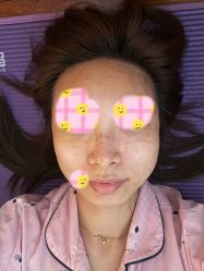 点击看大图 体验后-天津伊美尔医疗整形美容专科医院