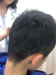 -菩叶脱发白发中心