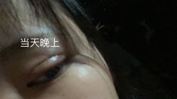 体验后-JS医疗美容