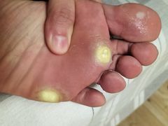 -朋朋修脚(友好广场店)