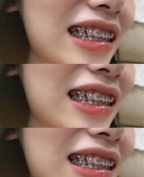 -安徽合肥韩美整形外科医院