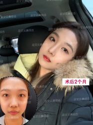 -北京米扬丽格医疗美容·联合丽格鼻整形中心