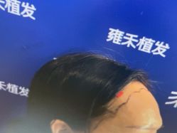 -雍禾植发全国连锁