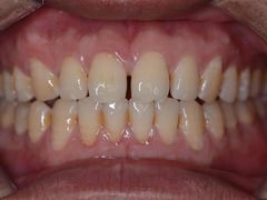 -新达口腔(华东理工大学店)