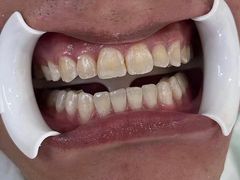 -圣贝口腔(海淀店)