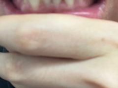-微笑牙科口腔(三亚迎宾院区)