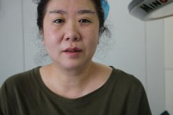 -天津健丽·去眼袋医疗美容机构