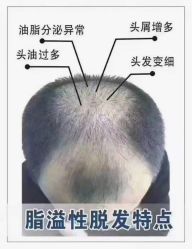 -诗碧曼·头疗养发馆