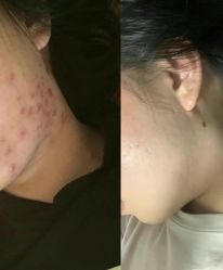 -Cream88颜皮肤管理中心