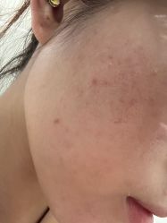 -广州美莱医疗美容医院