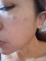 -天津健丽·去眼袋医疗美容机构