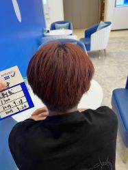 -大麦微针植发全国连锁