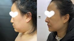 -洁铭新加坡医美