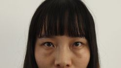 -天津健丽·去眼袋医疗美容机构