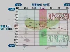 -自然之声助听器(平凉店)