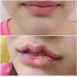 -上海漾颜医疗美容