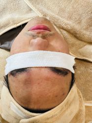 -美肤盾祛痘·问题肌头疗管理中心