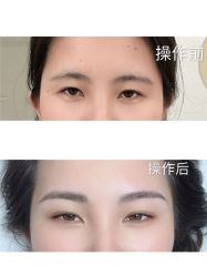 -久匠半永久纹眉