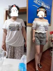 -瑞丝澜国际瘦身