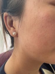 -广州美莱医疗美容医院