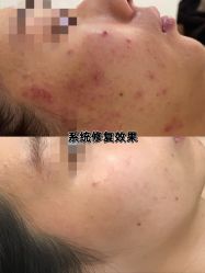 体验前-LUNA皮相美·骨相美高级美感