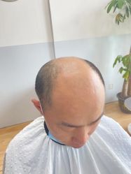 -发饰美男士增发补发假发定制店