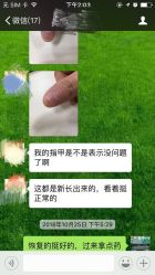 点击看大图 -德哥灰指甲脚气甲沟炎跖疣护理