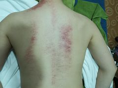 -喜艾堂艾灸馆(世贸天阶店)