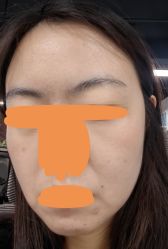 体验后-厦门美莱整形美容医院