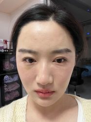 点击看大图 体验后-深圳美莱医疗美容医院