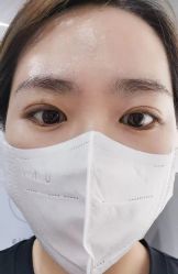 体验后-金圣医疗美容