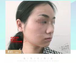 -圣嘉新医疗美容医院