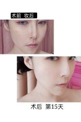 -大华韩艺整形美容医院