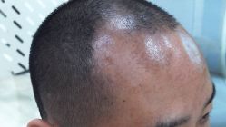 -雍禾植发全国连锁