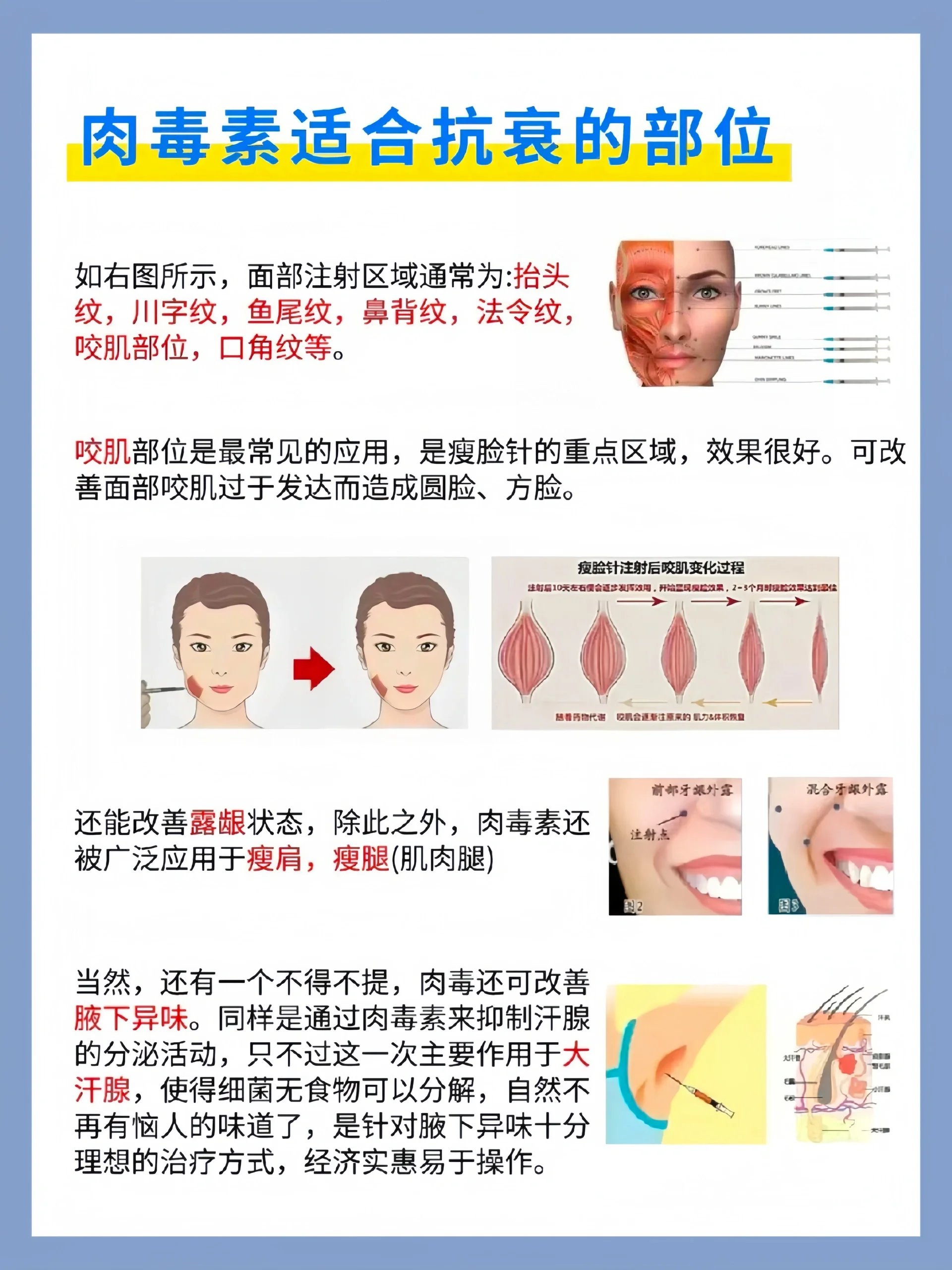 我打了5次肉毒素瘦腿图片