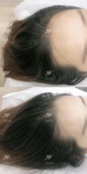 -西施无菌半永久纹绣眉眼影唇轻增发纹发际线
