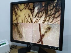 -章光101防脱养发荟