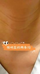 体验前-华臣医疗美容