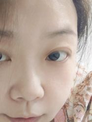 体验前-医方嘉明医疗美容