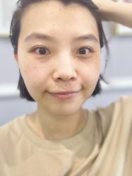 体验前-YooMee优美智能科技美肤机构